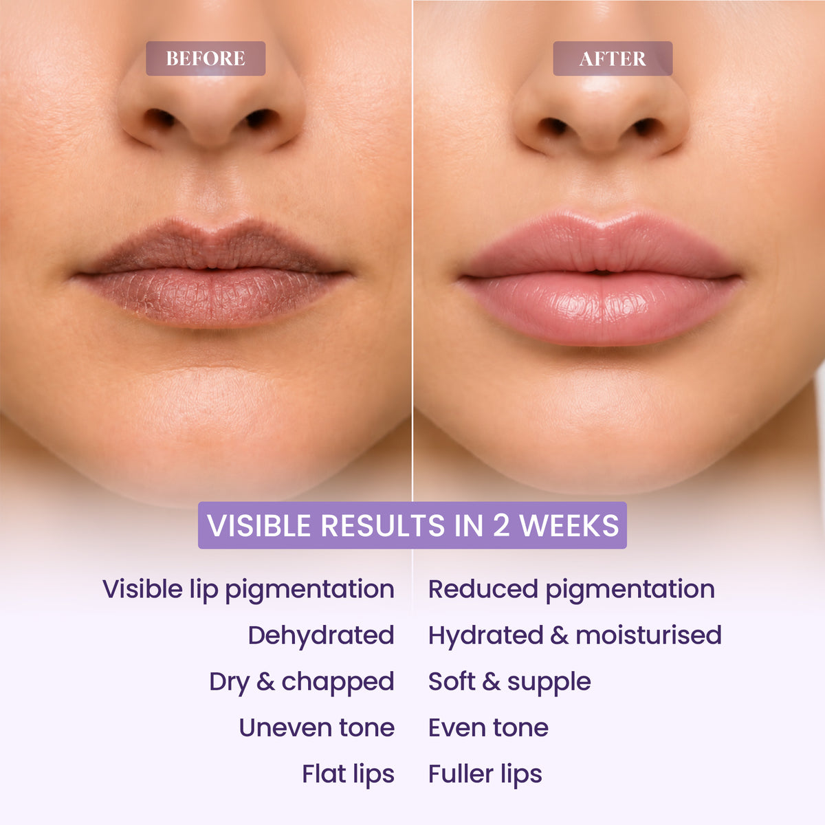 VOLUMIZING 5% Volufiline Lip Balm 5 gm
